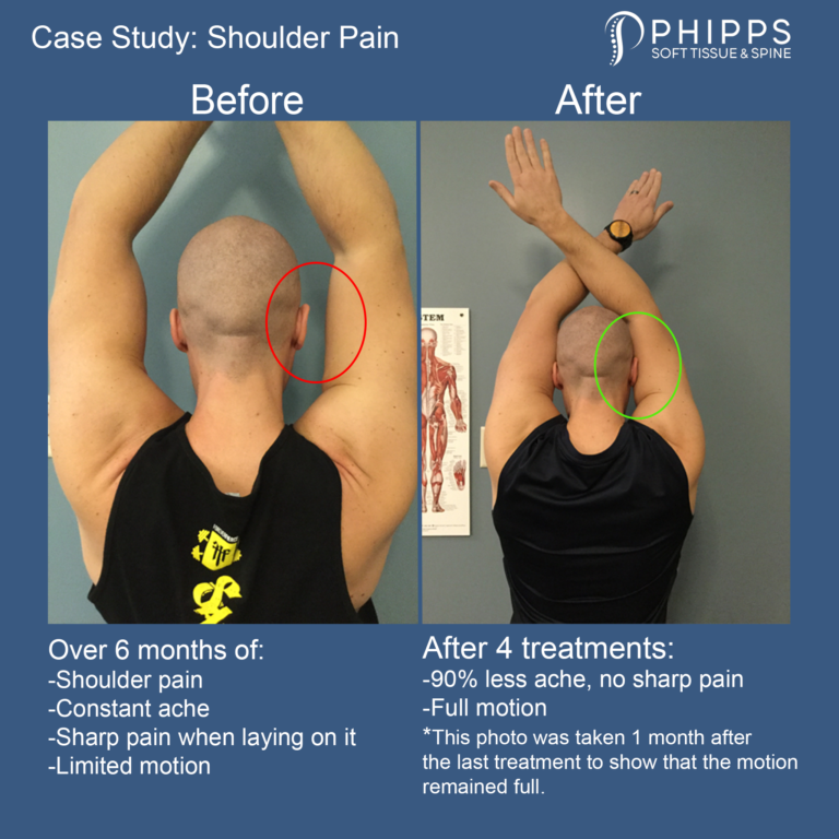 Shoulder Pain: Case Study  Phipps Soft Tissue and Spine