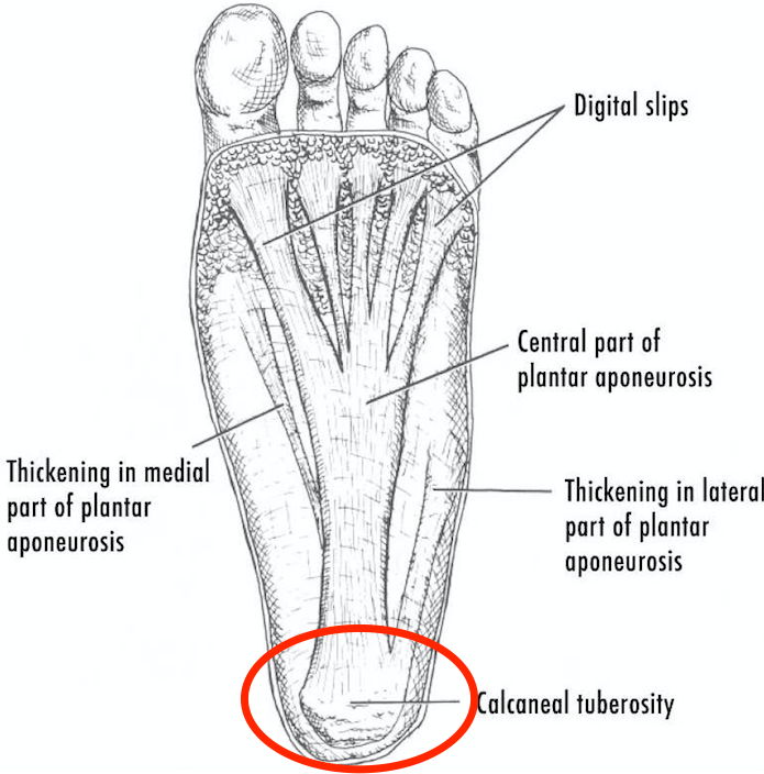 thickened plantar fascia treatment