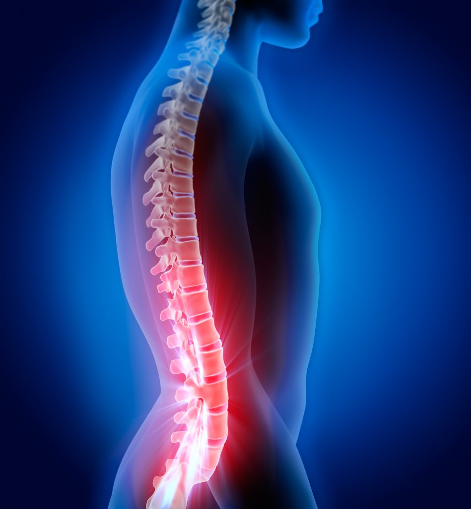 Spine illustration showing low back pain